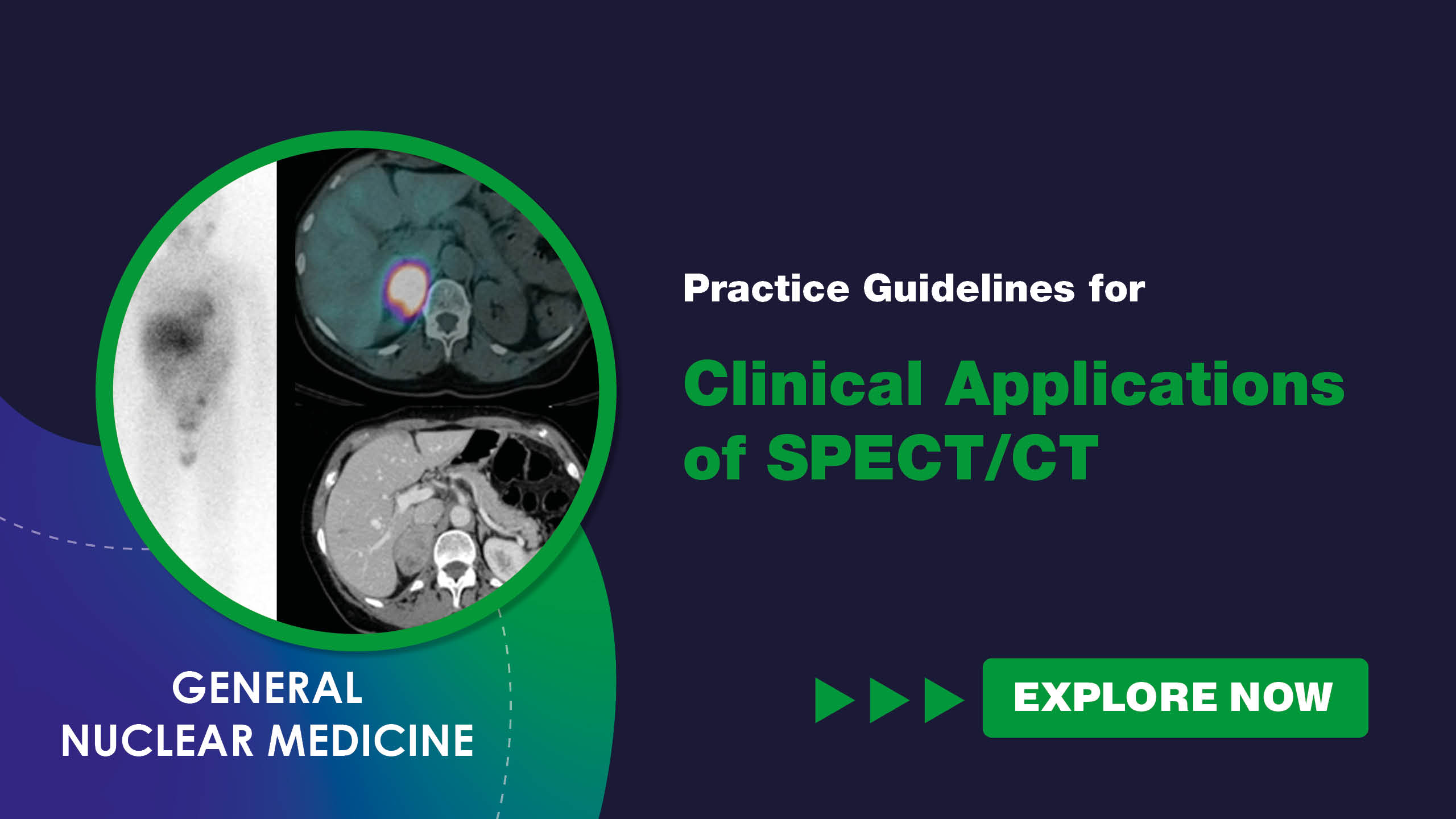Practice Guidelines for Clinical Applications of SPECT-CT