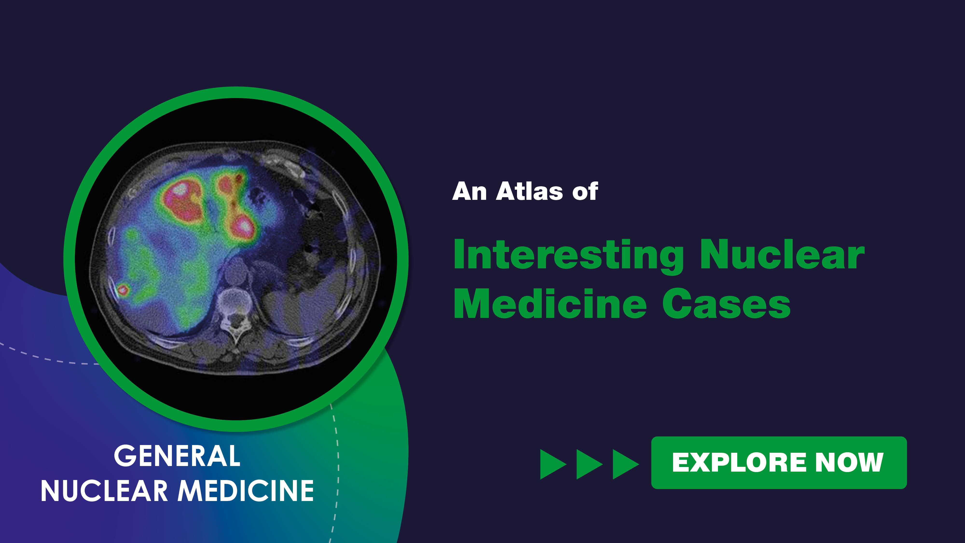 An Atlas of Interesting Nuclear Medicine Cases