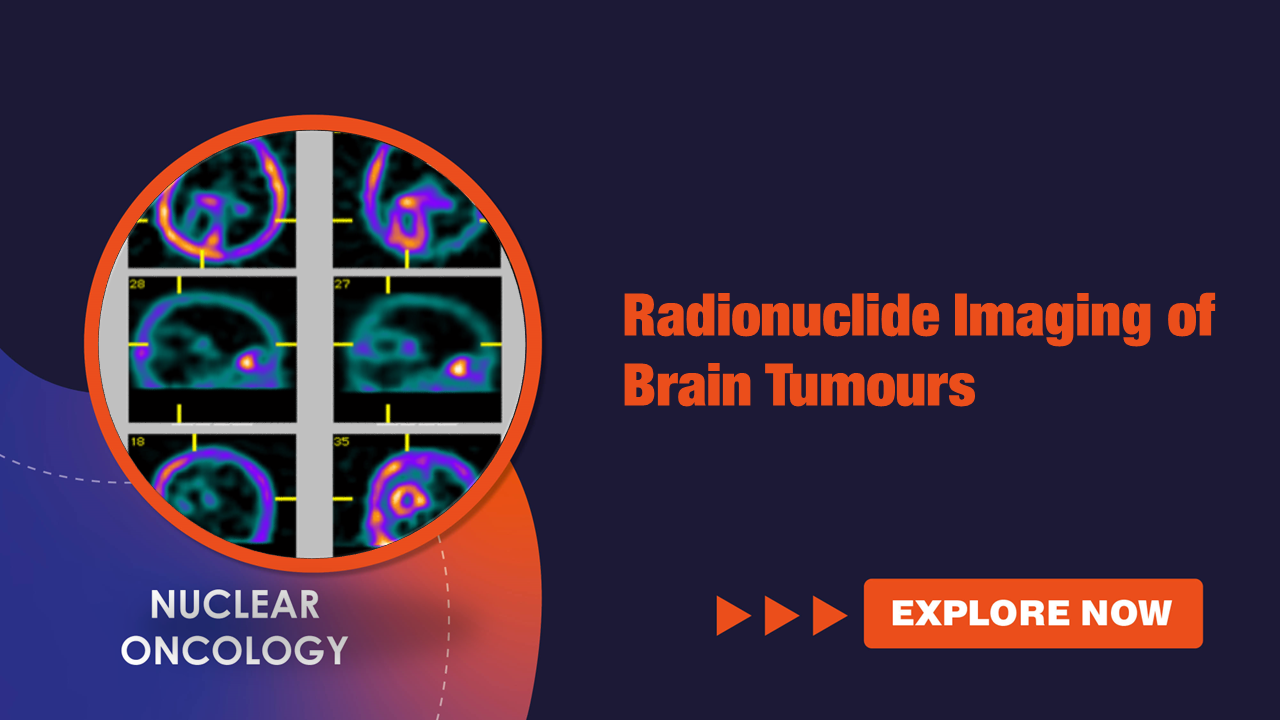 Radionuclide Imaging of Brain Tumours